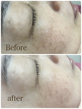 フェアリーヘア ニーナ(Fairy Hair Ni-na)/ハイドロジェリーマスクが優秀！