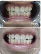 エクシアホワイト 長野店/