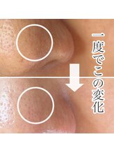 サロンドジョリー/1度でこの変化！！