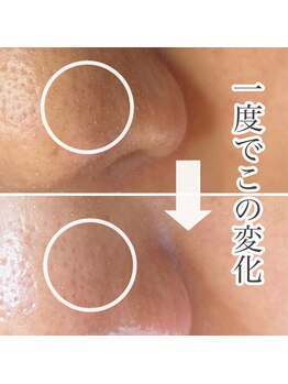 サロンドジョリー/1度でこの変化！！