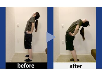 理学ゼーション 天王店/ビフォーアフター