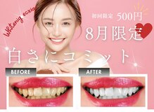 エクシアホワイト SOKA(ecxia white)