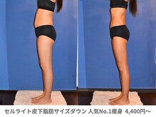 アンシャンテ 芦屋店/医師監修痩身