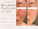 エープラス(A+)の写真