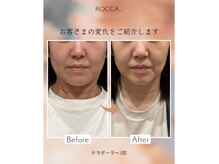 ロッカ(ROCCA..)の雰囲気（SNSで話題のテラボーラー！札幌でテラパックができるお店♪）