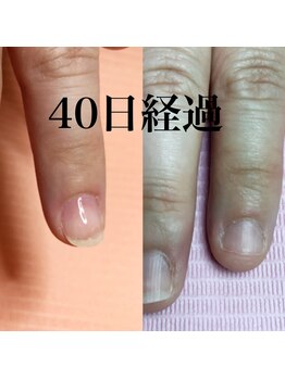 イリスネイル(IRIS NAIL)/