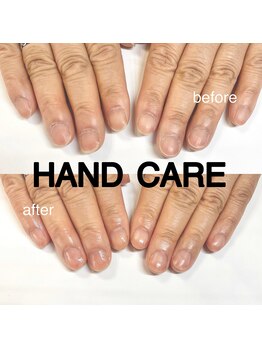 リーシュ 所沢店(RICHE)/ハンドケア/before &after