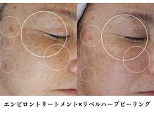 ブリエ 自由が丘(briller)