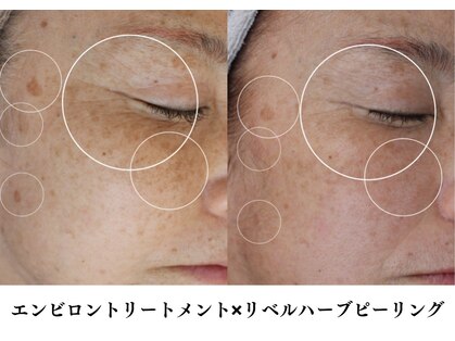 ブリエ 自由が丘(briller)の写真