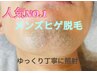 【メンズ髭脱毛】都度払いヒゲ脱毛　リピーター価格　¥3980