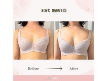 ミミバスト(mimibust)の雰囲気（短期間で驚きのバストアップ☆バストアップ/育乳/痩身/千葉）