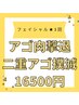 【光フェイシャル3回分◆お得なセット◎】あご肉撃退プラン！¥19800→¥16500