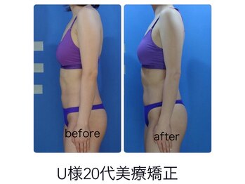 エステージ(estage)/