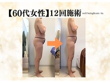 イタ 岡崎店(ita)/【　ビフォーアフター　】全身