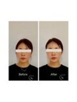 ハリラボ 仙台上杉店(hari Lab.)/【お客様の声】