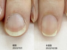 キアラネイル(Chiala nail)/自爪育成