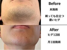 スキンスタジオトウキョウ(SKIN STUDIO TOKYO)