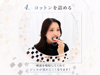 ホワイトニングサロン ホワイト 前橋店(WHITE)/4.コットンを詰める