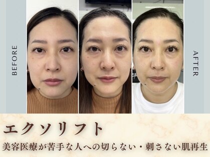 トータルビューティーサロンシーズン(Toral Beauty salon SEASON)の写真