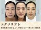 トータルビューティーサロンシーズン(Toral Beauty salon SEASON)の写真