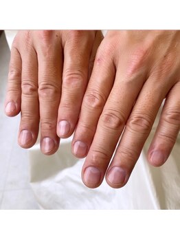 メンズケア募集