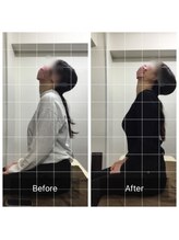 ナオル整体 福岡天神院(NAORU整体)/頭痛、寝つきの悪さ改善！