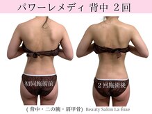 ラエッセ(La Esse)/ブライダルエステ