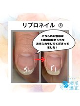 ブルームブルーム(BLOOMブルーム)/3週間でこの効果