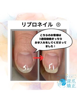 ブルームブルーム(BLOOMブルーム)/3週間でこの効果