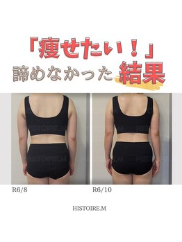 イストアールエム(HISTOIRE.M)/筋膜リリースダイエットコース