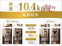 ボディベルム(BODY BELM)
