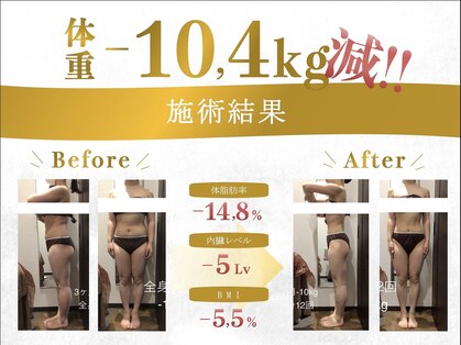ボディベルム(BODY BELM)の写真
