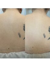 ラクシー 御徒町(luxssy)/背中シェービング