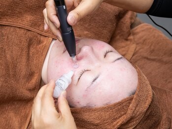 ナンバーナイン フェイスアンドボディケア(No.9)の写真/【水光生美容液トリートメント】or韓国艶美肌ピーリングトリートメント【シーナジーピール】で肌質改善！