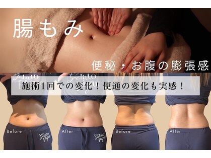 ラシーン(Racine)の写真