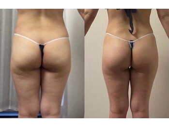 アプロディタ/桃尻作ります！