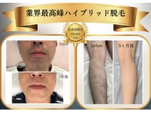 ベルフィーヌボーテ(BELFINE beaute)の雰囲気（効果抜群！佐世保で話題の脱毛店！）