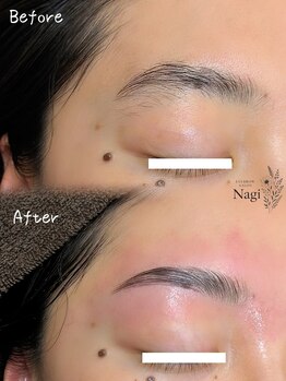 ナギ(Nagi)の写真/下がり眉・困り眉も上向きに！諦めていた「眉癖」を根本から矯正して、自分史上最高の垢抜け美眉を叶える。