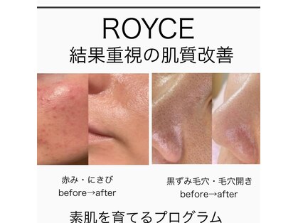ロイズ(ROYCE)の写真