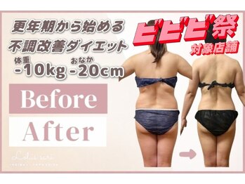ロータス サリ 中野坂上の写真/徒歩30秒★大人女性の為の<リンパのお掃除専門サロン>更年期から始まった体の不調を根本改善！リンパ節ケア