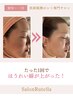 【リピーター様限定】ライト肌質改善コース
