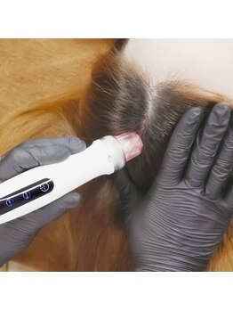 フロウ(Flow)/次世代スカルプケア★ノアグロウ