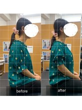 ナオル整体 武蔵小杉院(NAORU整体)/20代女性　姿勢矯正