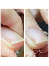 ルアナネイル(Luana Nail)/フットケア