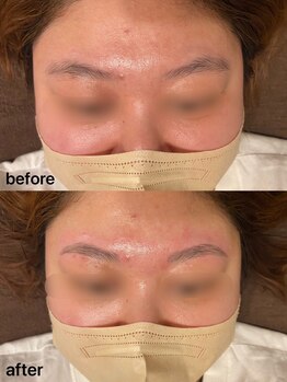 パピヨン(papillon)/ハリウッドブロウリフト【HBL】