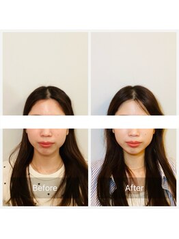 ハリアー(HARRIER)/ビフォーアフター