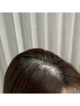 マイントゥー(mine too)/分け目部分が気になる方も