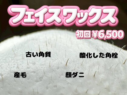 ラダ(RADA)の写真