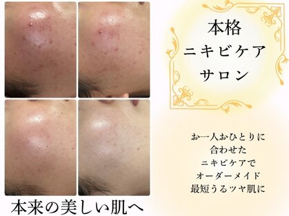 リノ(Lino)の写真