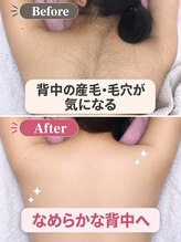 アルゴ 熊本健軍店(ALGO)&nbsp;ビフォー アフター